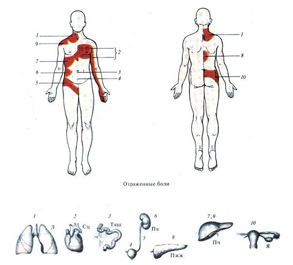 Точки болезненности. Схема болей на теле человека. Боли у человека на схеме. Левое плечо организм схема. Очаги боли на спине схема.